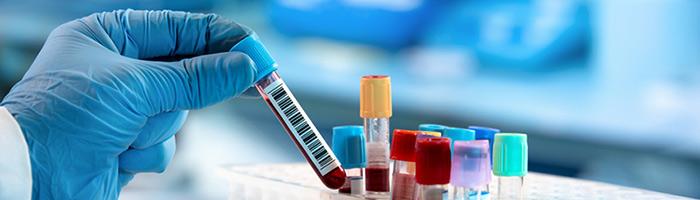 Временные рекомендации Международного общества специалистов по тромбозу и гемостазу (ISTH) по выявлению и коррекции коагулопатии у пациентов с COVID-19: дайджест Временные рекомендации Международного общества специалистов по тромбозу и гемостазу (ISTH) по выявлению и коррекции коагулопатии у пациентов с COVID-19: дайджест